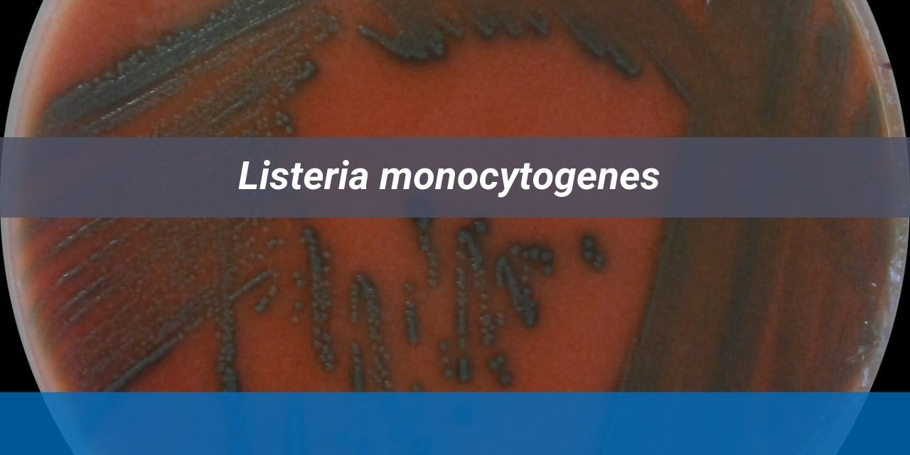 test for Listeria monocytogenes test for Listeria monocytogenes