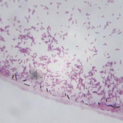 Clostridium perfringens Clostridium perfringens gram stain test